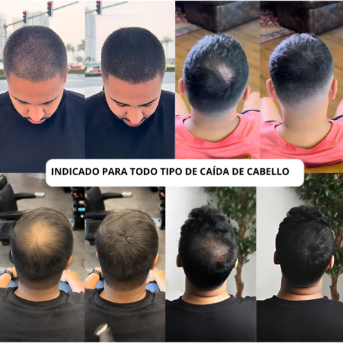 Camuflaje Capilar