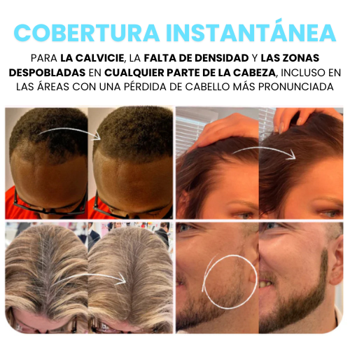 Camuflaje Capilar